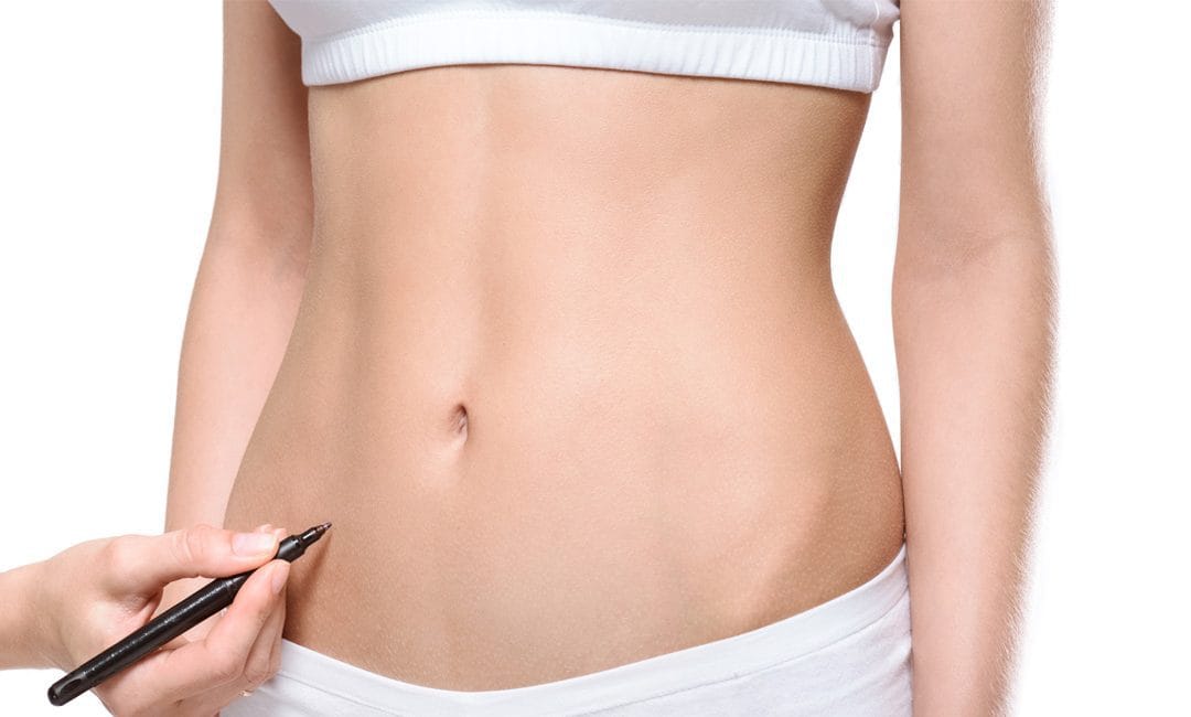Liposuccion : ce que vous devez savoir