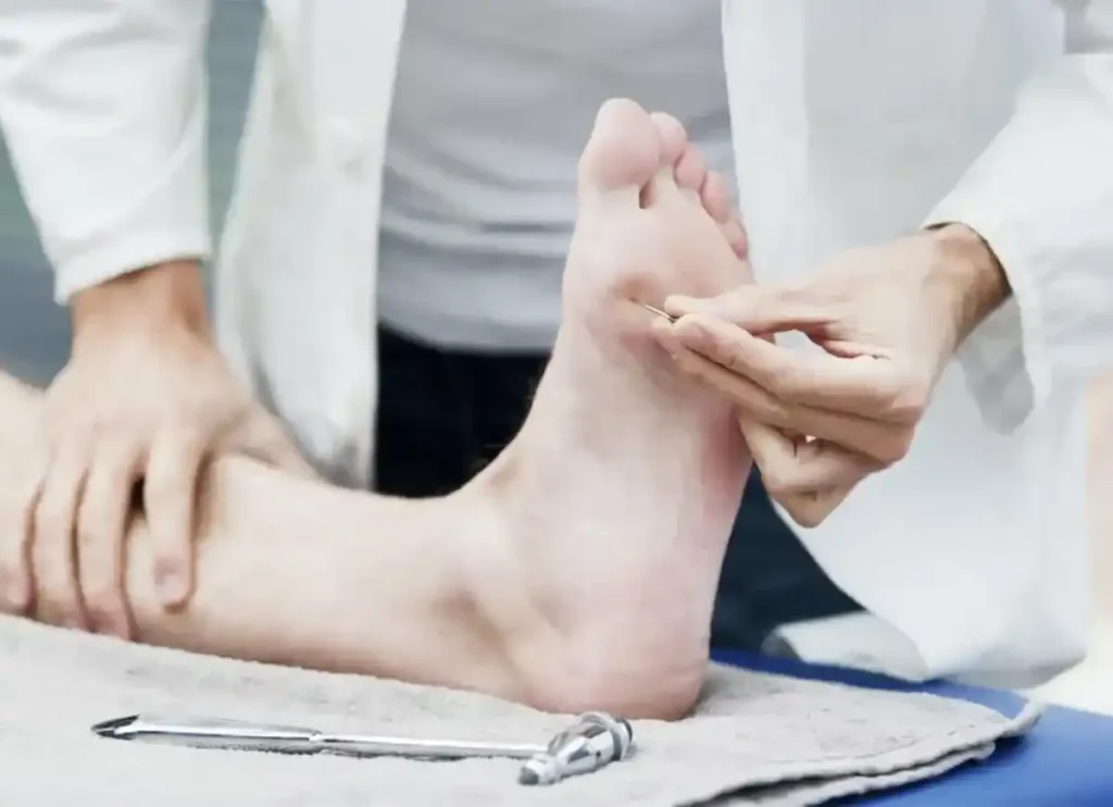 Pieds diabétiques